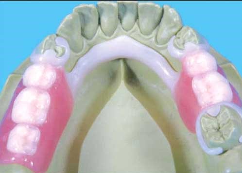 Upper Dentures Mexico PA 17056